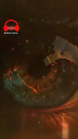 #foryoupage❤️❤️ #ethioneshida #viralvideos #minbertv #viralvideos 