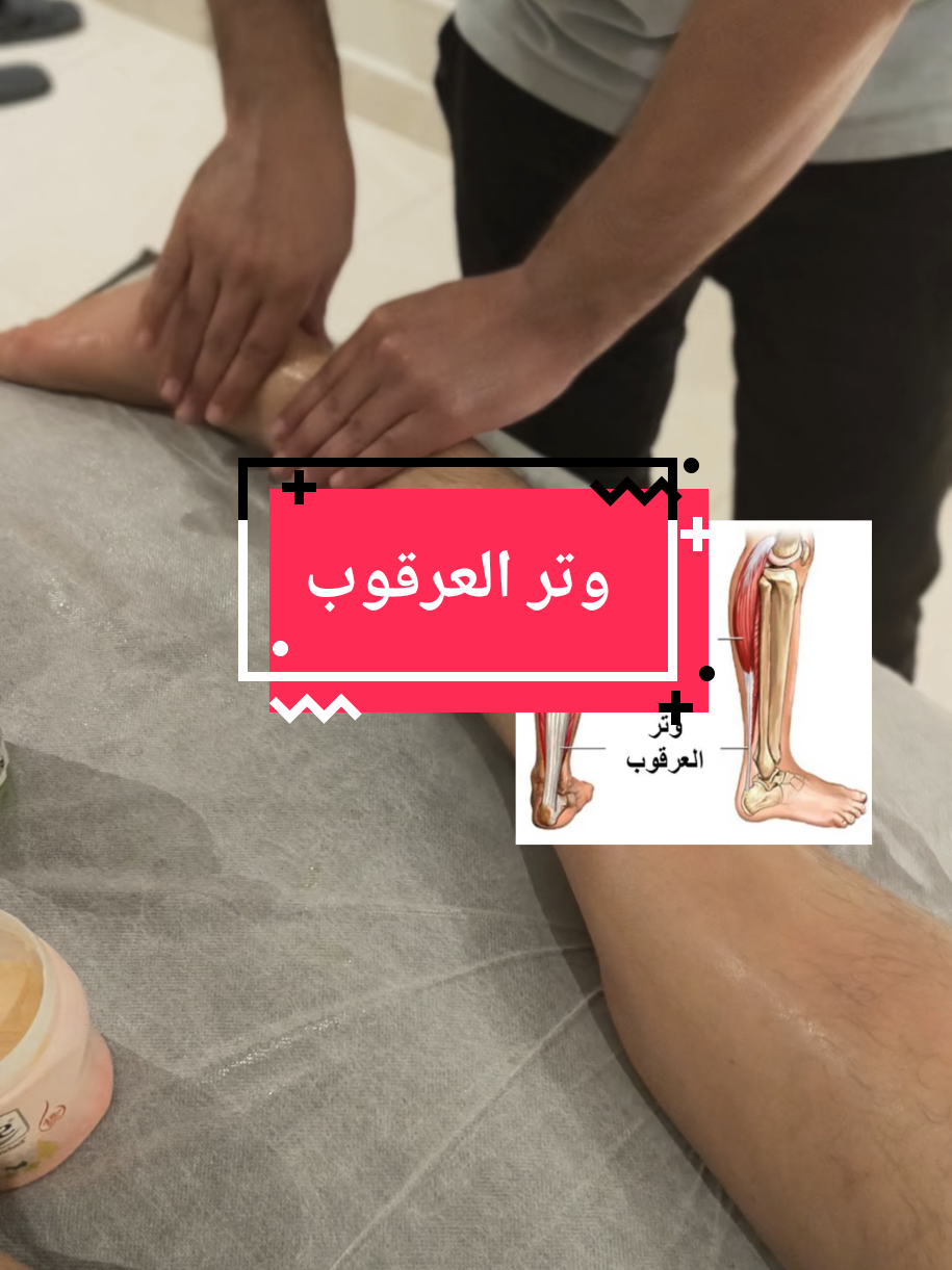 وتر العرقوب : هو وتر يربط بين عضلة السمانه وعظمة الكعب #كابتن_أمجد #مساج #foryou #viral #fyp 