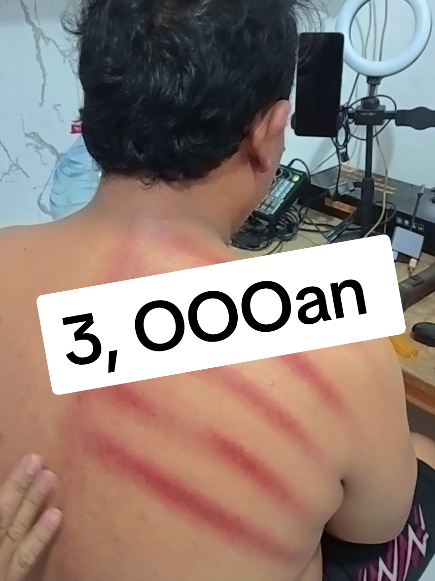 #AlatKerokan #AlatBekam 