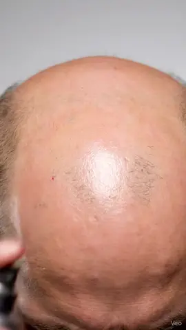 tag me someone who needs THIS growth spray #usa🇺🇸 #hairgrowth #satisfyingvideo #foryoupage #asmrspray 