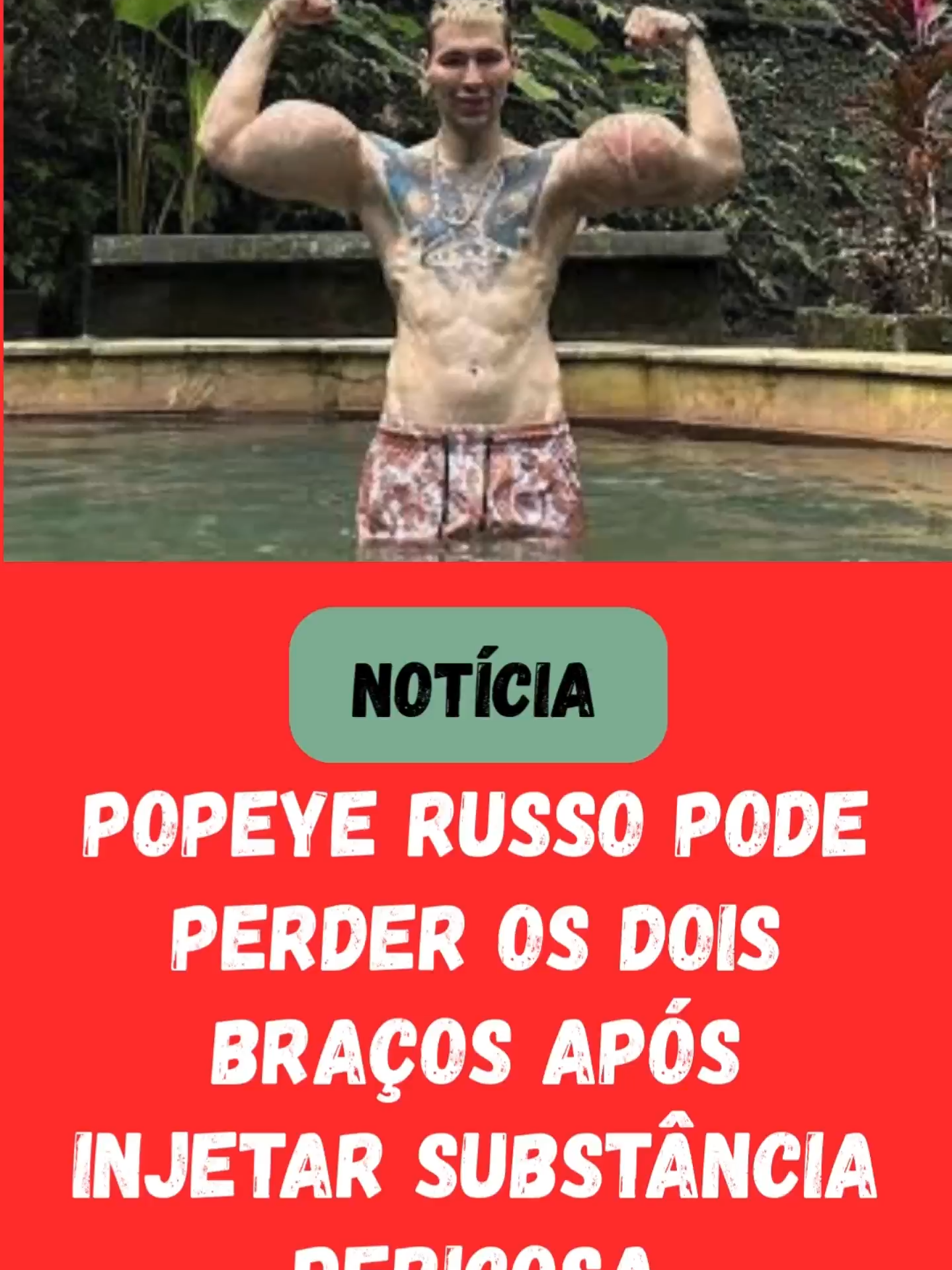 POPEYE RUSSO PODE PERDER OS DOIS BRAÇOS APÓS INJETAR SUBSTÂNCIA PERIGOSA!    Influencer russo conhecido como 