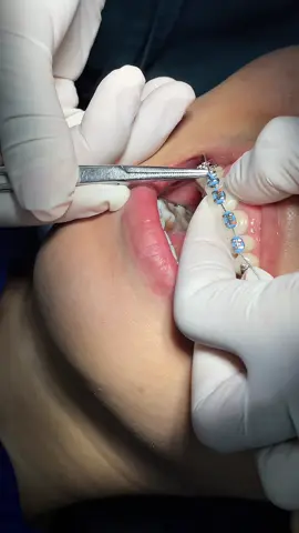 my fav color 🩵🫶🏻#brightsmiledentalhospital 