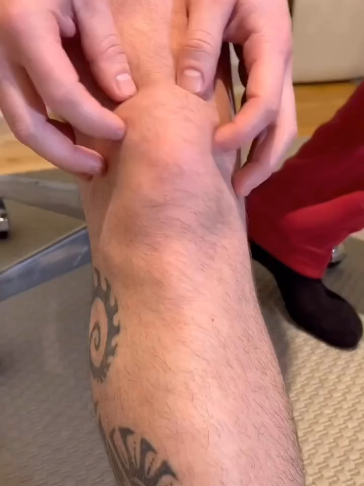 🩺 Fact: Patellofemoral instability refers to a condition where the kneecap (patella) repeatedly dislocates or moves out of its normal position in relation to the thigh bone (femur). It can cause pain, swelling, and a feeling of instability in the knee joint.  💪 Fact: Kinesio taping can be an effective treatment option for patellofemoral instability. It involves applying a special tape to the skin around the knee to provide support, stability, and improve muscle function. The tape helps to realign the patella and reduce excessive lateral movement.  By #georgi.therapy