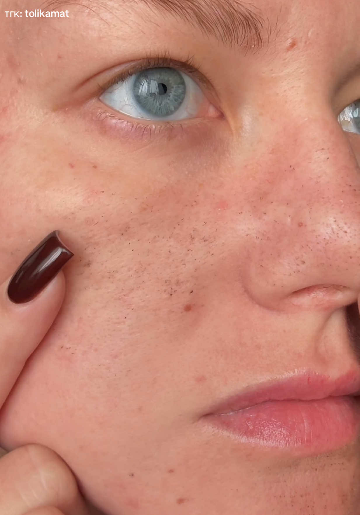 Кстати,для лучшего эффекта перед маской можно распарить кожу 🥵 Все продукты @SKIN1004 US  #корейскийуход #уходзакожей #skin1004 #косметика #корейскаякосметика 