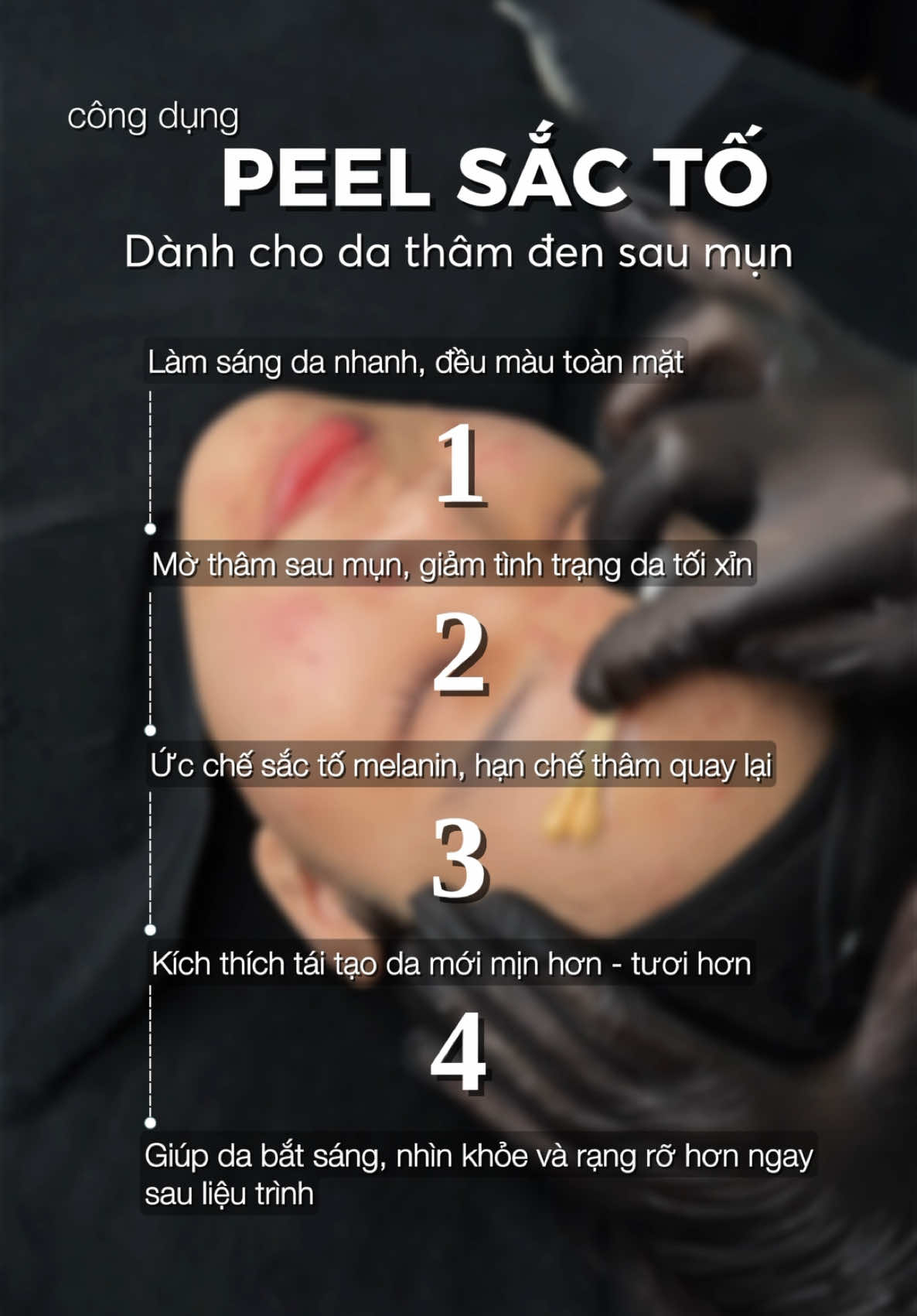 ✨ PEEL SẮC TỐ  ✨ Nếu mng đang có thâm mụn, sạm da, đốm nâu lâu năm hay da xuống tone rõ rệt? Pp này giúp làn da bật sáng nhanh – đều màu rõ – mờ thâm thấy ngay chỉ sau 1 buổi. ✔️ Phá vỡ hắc sắc tố dưới da ✔️ Làm sáng vùng da xỉn màu ✔️ Tăng sinh collagen cho da mịn – căng – khoẻ ✔️ Không bong tróc nặng, không đỏ rát ✔️ Hiệu quả rõ trong 24h Inbox ngay để được soi da miễn phí & lên phác đồ cải thiện sắc tố chuẩn nhất! ✨ #viralvideo #tssglowlab #peel 