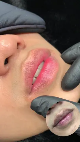 Lên môi nữ hoài nay em lên môi nam nhà em cho mọi người xem nha 😋#phunmoitunhien #phunmoitanvien #phunmoidep #khuthammoi #molisebeauty 