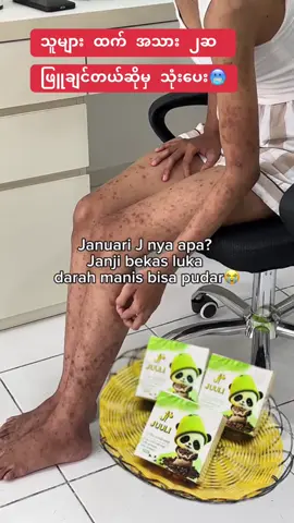 #Juuli_1ခဲ_13500 #အသားဖြူချင်သူများအတွက် #juuliscrubsoap💚 #မဖြူရင်ငွေပြန်အမ်းမယ်🔥 #အိမ်ရောက်ငွေချေနဲ့ပို့ပေးပါတယ် 