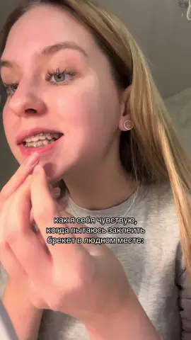 довели. #fyp #брекеты #ортодонт #smile 