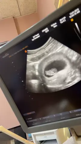 🥹نازداری دایە