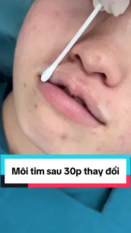 Tạo hình môi tim #catmoi #cắtmôi #catmoidep #xuhuongtiktok #ilovetiktok 