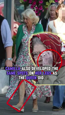 Camilla also developed the same spots on her legs as the Queen did #usa #tiktok #fyp #queen #royal #crown #celebrity 