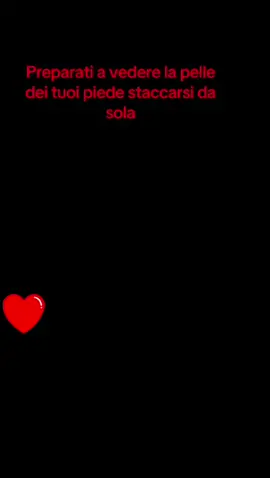 la maschera piedi più virale torna anche quest’anno! 🔥 Summer Foot elimina callosità e pelle secca con un peeling super efficace. Dopo pochi giorni… piedi morbidi come nuovi! 😍 Perfetta per chi vuole risultati veri senza fatica. #SummerFoot #MascheraPiedi #PeelingPiedi #CalliAddio #PiediMorbidi 