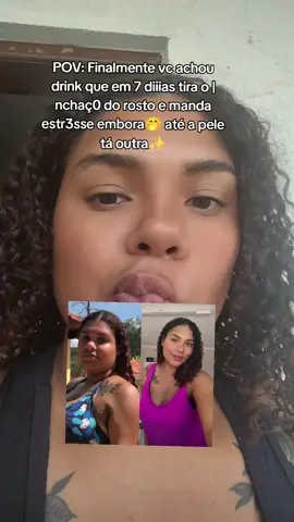 Finalmente💙 #inchaço #fypage 