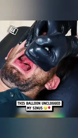 I have never felt so relieved after surviving the wild battle between me and my stubborn cold and honestly it felt like my nose was running a marathon while I was just standing there trying to breathe like a normal human and every sneeze felt like a surprise jump scare that I did not sign up for but here I am finally breathing like a champion again and the world suddenly looks brighter and warmer and I am low key emotional about it because nothing makes you appreciate life more than finally feeling air move through your nose again and now I am walking around with this proud little smile because I survived the chaos and the sneezing explosions and the nonstop nose drama and I feel like I deserve an award for not giving up even when I sounded like a broken trumpet and now that the sinus pressure is gone I swear I can hear colors and smell happiness again and honestly this moment feels like pure victory and I am celebrating it like a festival because good health hits different when you come back from the trenches and now I am just vibing with big relieved energy #trendingnow #viralvibes #relatablelife #fyp #funnytake 