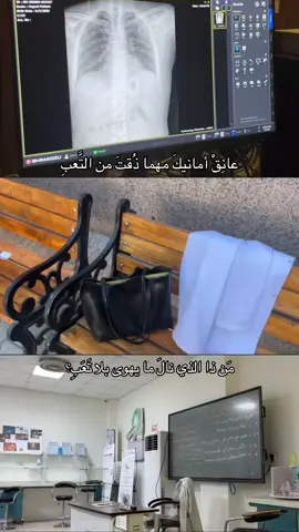 #CapCut #اكسبلور #النجف #الجامعة_الاسلامية #اشعة_سونار 