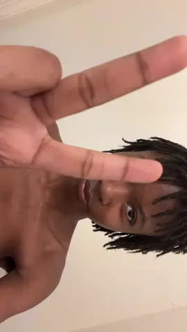 AAYYHHH THIS PIMPLE BRO??