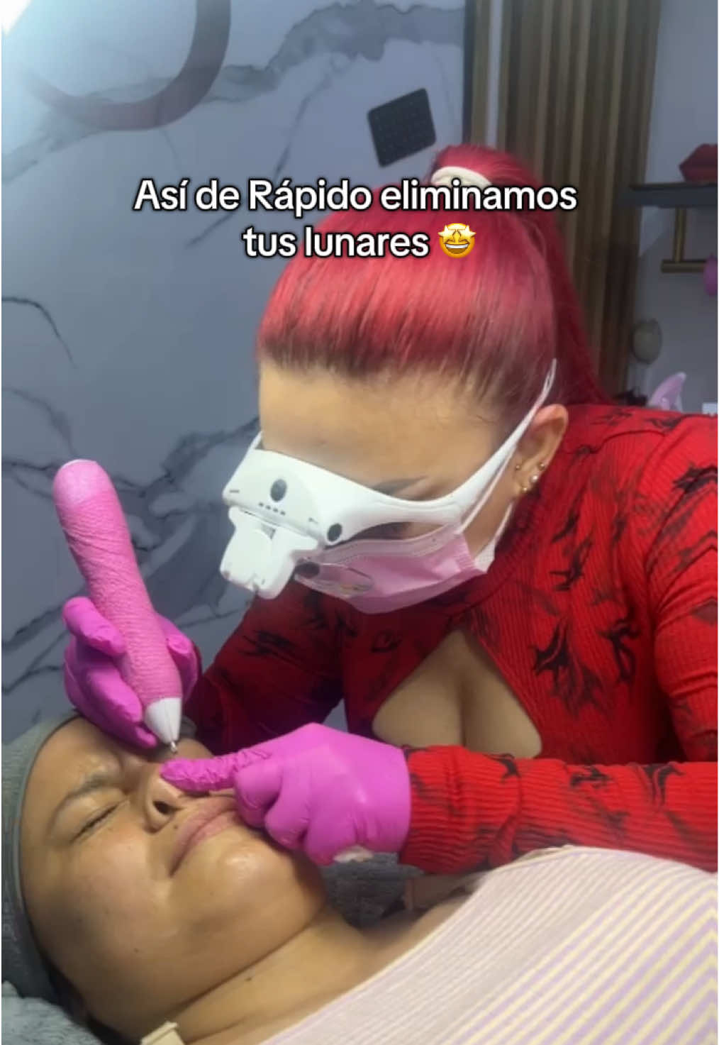 ✨ Eliminación rápida y segura de lunares en Seleidy Stetica ✨ Despídete de esos lunares que no te gustan con nuestra técnica láser cauterizadora, la opción más precisa, rápida y segura para lograr una piel más limpia y uniforme. ✔️ Resultados inmediatos ✔️ Mínima molestia ✔️ Piel más lisa y estética ✔️ Recuperación rápida 📍 José Gálvez 476, local 205 – Magdalena, Lima 📞 918 349 131 #Lunares #EliminaciónDeLunares #Laser #PielPerfecta #SeleidyStetica  m