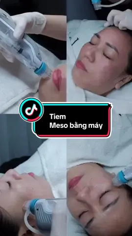 Làn da đẹp không tự nhiên mà có, nó đến từ dưỡng – phục hồi – nuôi da đúng cách, và meso chính là chiếc chìa khóa 🥰🥰 #meso #tiemmeso #tiemmesocangbong #mesooxyx_trắng_da #nguoivietnamtaidailoan 