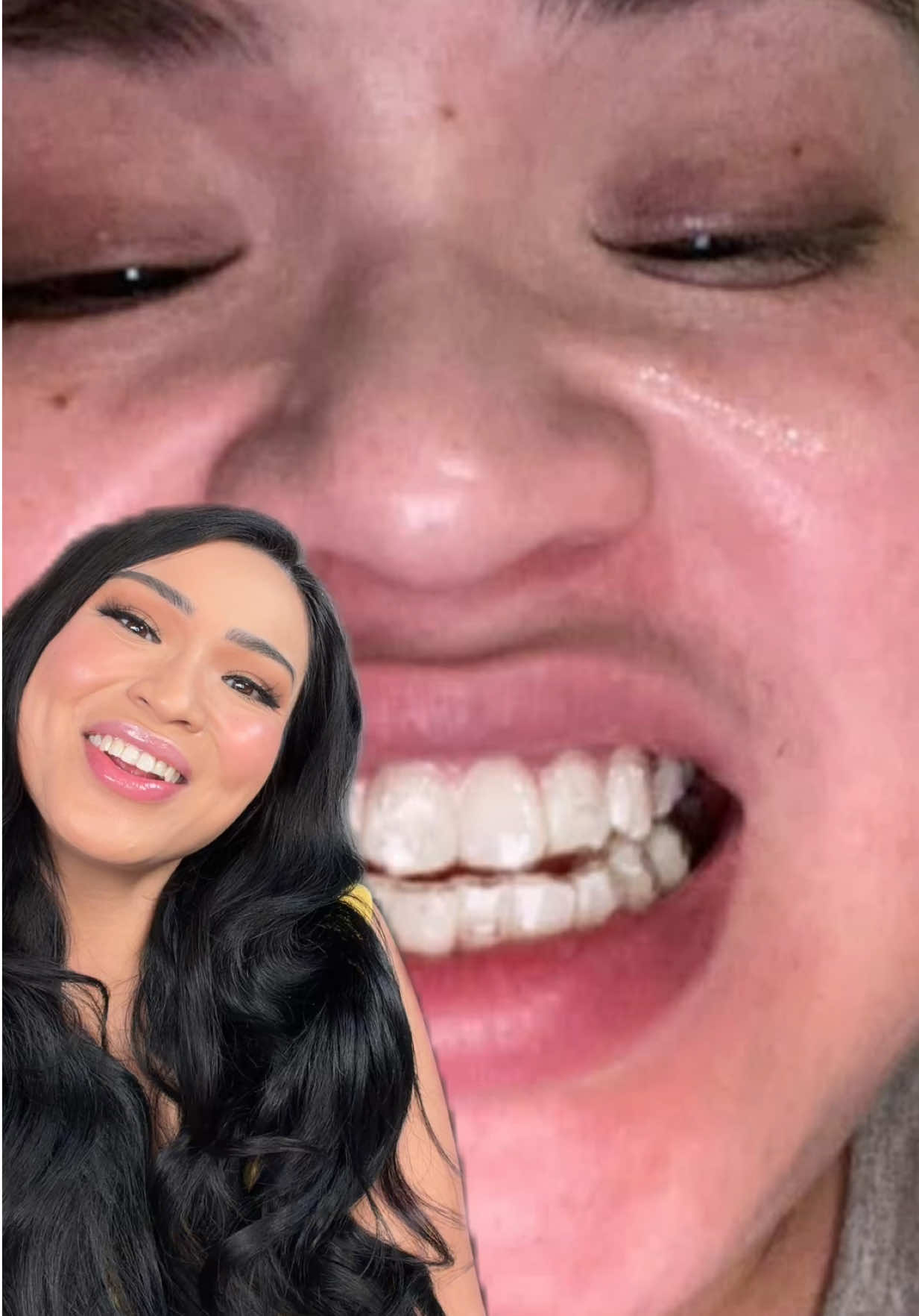 Hi @Invisalign I just want to say u changed my life. I’m SO happy with my smile 🥹 