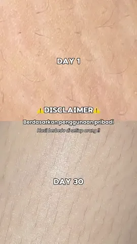 Kalian jangan sampe nyesel kaya aku juga dehh🥵#stretchmarks #stretchmark #stretchmarkserum #stretchmarkoil #ciaraindonesia 