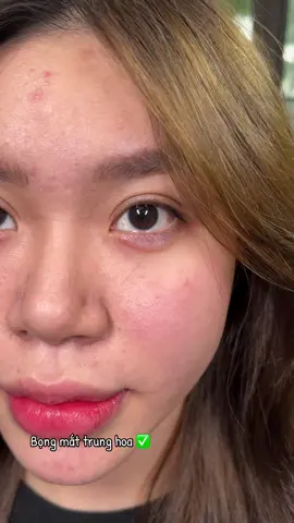 #beauty #pttm #tiktokviral #FillerAnToàn #fypシ 