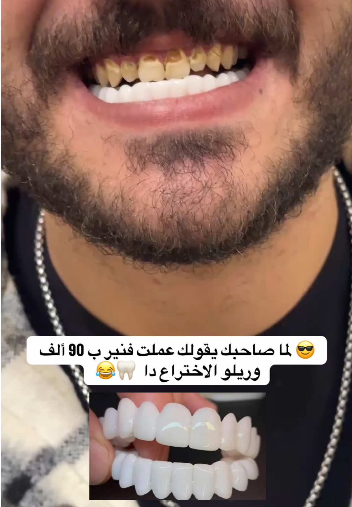 #snap_on_smile 🦷✨🌸 🌸 للتواصل عن طريق رسائل الصفحه 📩  أو عبر الواتساب  01019202217  🦷 📱