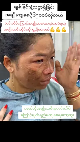 ချစ်ခြင်းနဲ့သစ္စာရှိခြင်းအချိုးကျလှပကြပါစေ#avocodo #တင်းတိပ်အမဲစက်ပြောက်ချင်သူများအတွက် #TTA #foryou #fyppppppppppppppppppppppp 