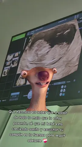 #contenido #baby #12semanas #CapCut 