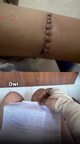 Kematian tragis Dwi Putri Aprilian Dini (25) membuka dugaan praktik penyiksaan sistematis di sebuah agency pemandu lagu di Batam. Setelah kasusnya mencuat, para korban lain mulai bersuara, mengungkap pola kekerasan yang sama: diborgol, dipukul, disiram air, dipaksa menelan obat penenang hingga belasan butir, serta dipaksa minum alkohol. Kesaksian juga menyebut ada korban yang disekap berhari-hari tanpa makan dan hampir tewas. Cara pelaku membawa jenazah Dwi Putri ke rumah sakit jauh dari lokasi kejadian pun menambah kejanggalan. Testimoni para korban memperlihatkan bahwa kekerasan ini diduga sudah berlangsung sejak 2022 dan bukan kejadian tunggal. Keluarga dan para penyintas kini mendesak polisi mengusut tuntas jaringan pelaku serta memastikan semua korban berhasil diselamatkan. #batam #batamnews #kepri 