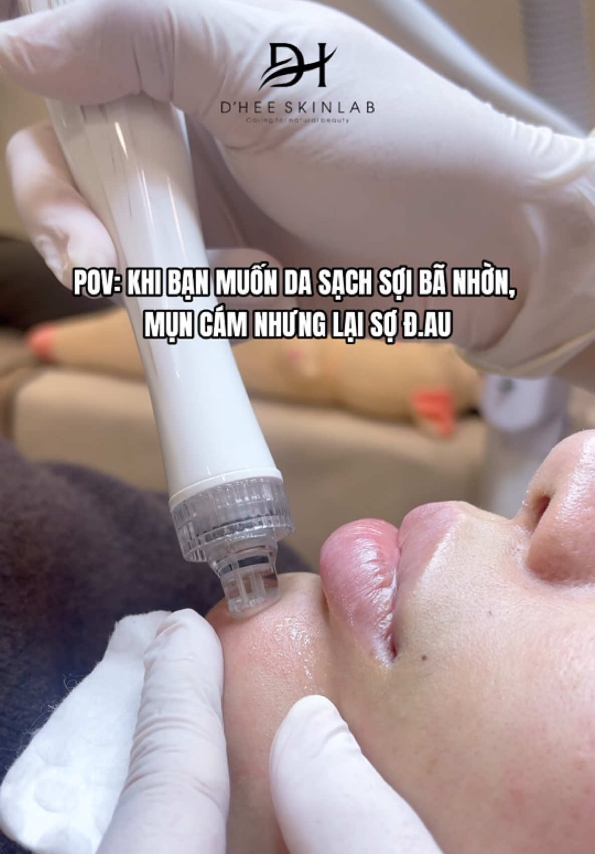 Muốn da sạch sợi bã nhờn, mụn cám thì không thể bỏ qua aqua peel #reviewlamdep #dheeskinlab #xh #spaphunhuan #aquapeel 