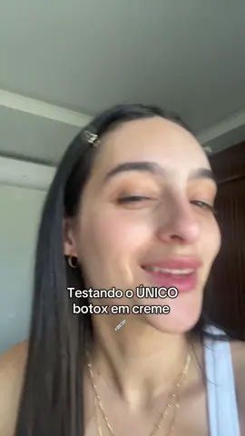 Maravilhoso  #botox #bisyou #linhasdeexpressão #rugas 