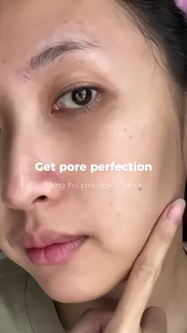 Get pore perfection!✨  #skin1004 #pinkpamore #poremizing #centellaporemizing #poremizingfreshampoule 