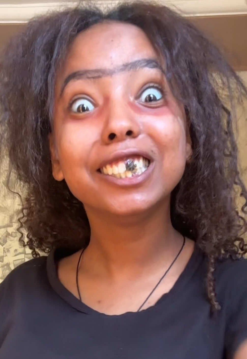 Before and before የሆነ ነገር 😭#fypシ゚ #ethiopian_tik_tok🇪🇹🇪🇹🇪🇹🇪🇹 #ሀበሻ🇪🇹🇪🇹🇪🇹tiktok #viral #transition @Tomas Hailu 