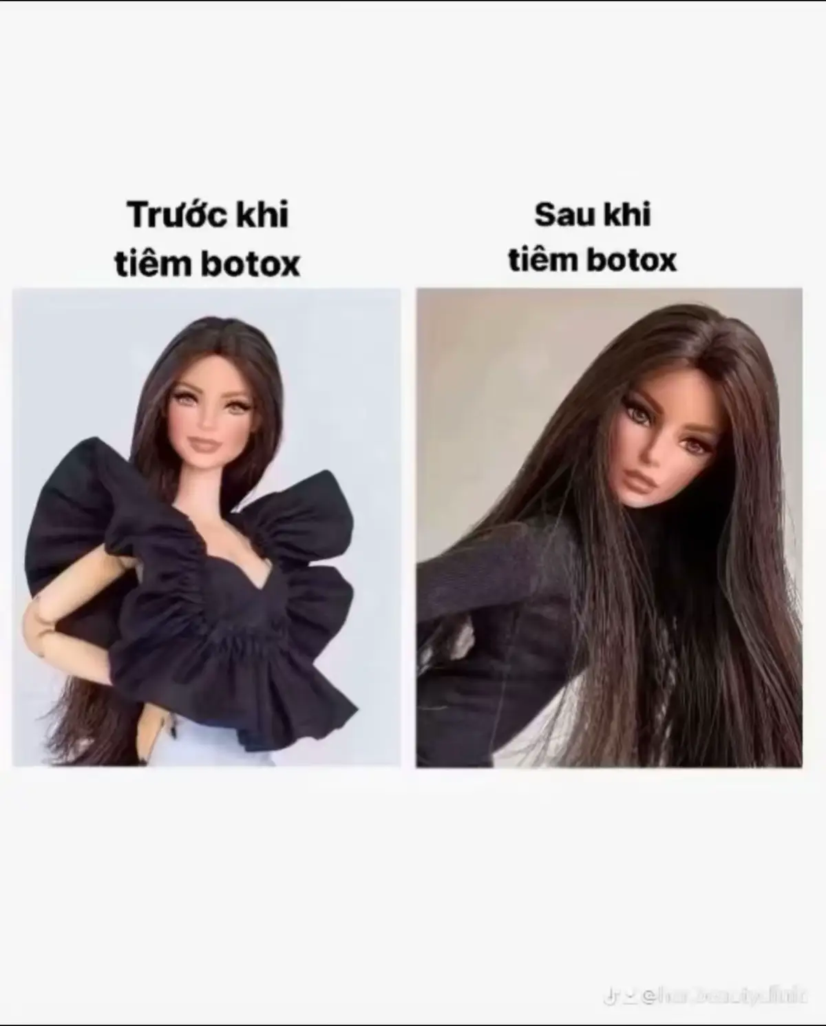 bà nào mặt vuông lệch thì bơi zô đây nha #botox #tiembotox #botoxgonham #tiembotoxgonham #botoxthongonham 