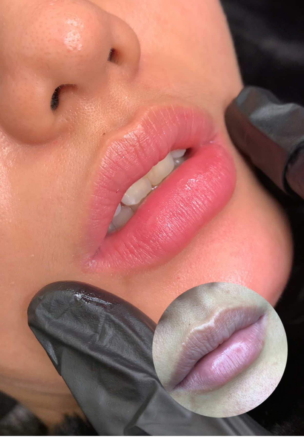 Môi đủ vuýp cho ngày hôm nay! #phunmoitunhien #phunmoitanvien #phunmoidep #khuthammoi #molisebeauty 