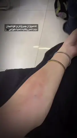 تـەنیـا خـۆتـی🖤#actives? #foryouuuuuu#accccccccccccccccccccccccccccccc #actives? #imrove✅ 