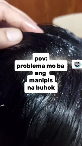 mommy panalo to sa benefits kaya magpabudol ka na rin#hairgrowth #castoroil #castoroilbenefit #castoroilforhair #selfcareroutine 