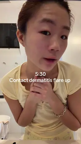 Pls help MY FACE HAS HAS ENOUGH 