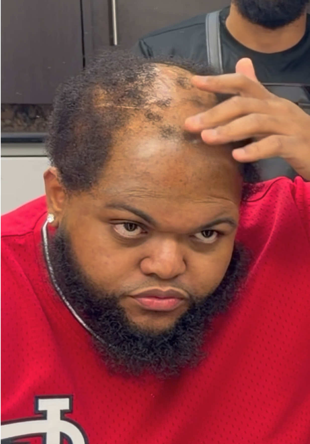 Dudes put a Hat on & be 30 Years Younger #Hatfish 😂😂😂😂😂 #druski #bald #skit #hair 