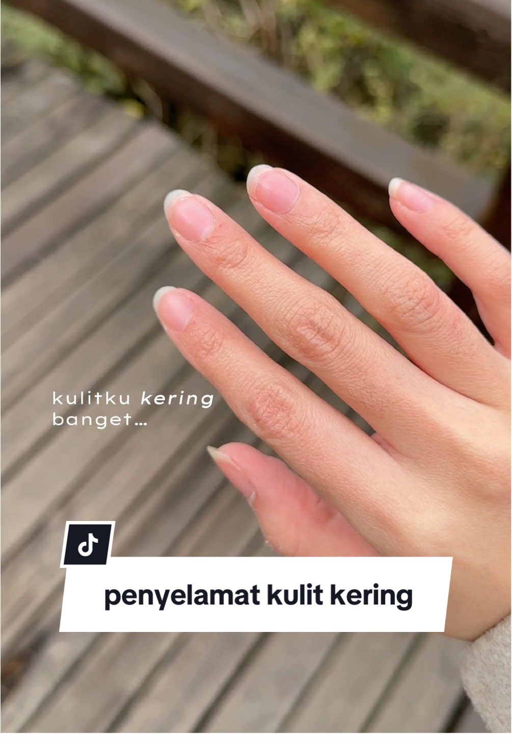 buat yg kulit kering pasti cocok sih, 1 layer tipis aja udah cukup soalnya ini moisturizing banget! 🫶🏻 #BekasLuka  #CreamBekasLuka #CreamGatal #CreamIritasi #CiaraIndonesia 