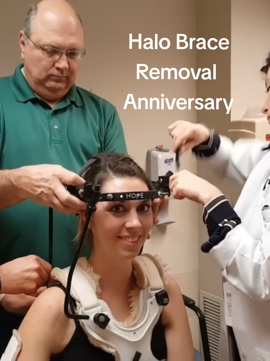 Halo brace removal 9 years ago. I can't even believe it. So much happened since then. I was in it for 8 months. Fused skull-T2. It felt so weird to be free of the halo. I sincerely missed it. I felt really good in the halo. When it was removed I felt very skinny lol.  #fyp #foryourpage #foryoupageofficiall #ehlersdanlos  #authentic 