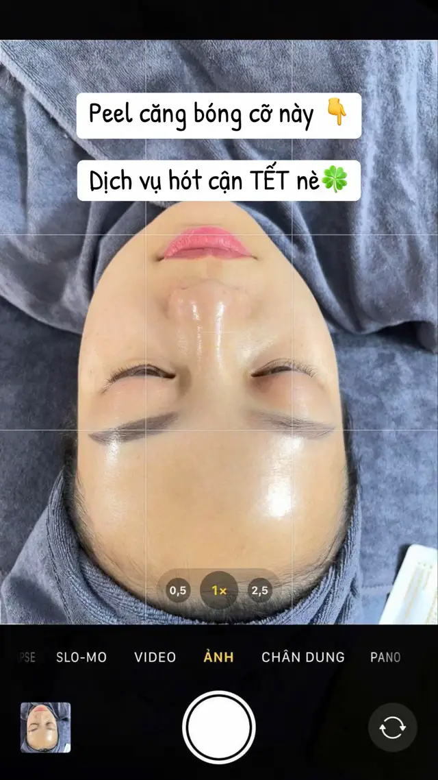 Peel căng bóng đón Tết 2026😘 #daotaohocvien #điều_trị_mụn_nám_rỗ_tàn_nhang #trắngda #peelda #xuhuong 