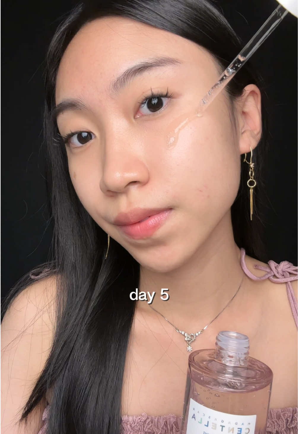 Progress after rutin pake #centellaporemizing 🫶🏻🤩 so fall’ in love 💗 #skin1004 #pinkpamore #poremizing #poremizingfreshampoule 