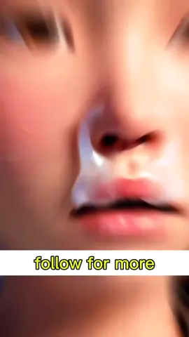 closed nose in winter #facts #foryou #unfreezemyaccount #scienceexplain #fyp 