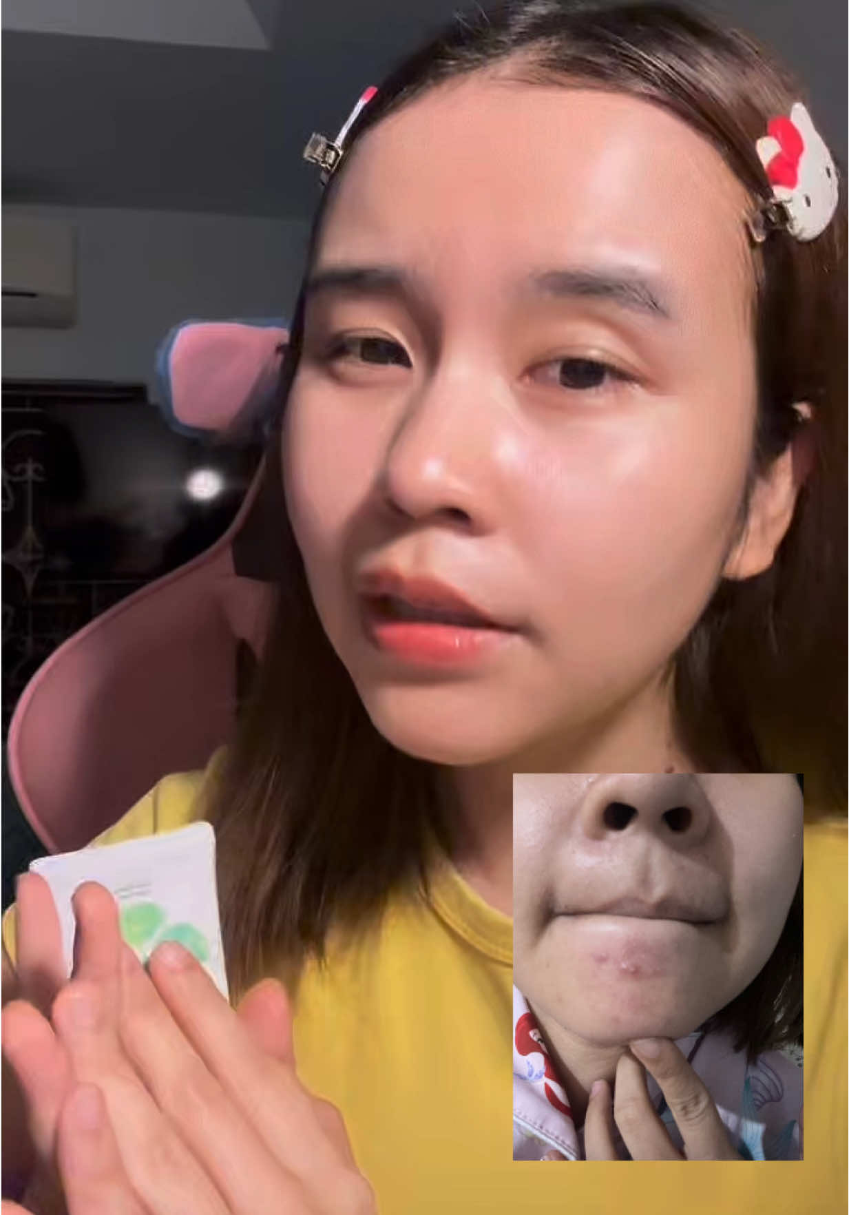 ทำไมไม่แมส #เทรนด์วันนี้ 