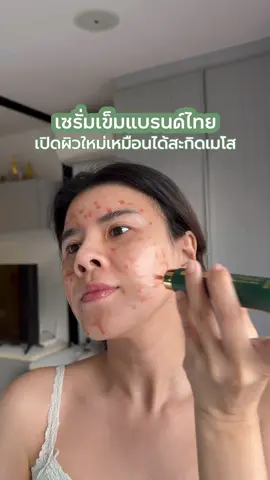 เซรั่มเข็มที่มีเข็มในเนื้อเซรั่มจริง เจ็บยุบยิบบนผิว แต่คือการเปิดทางผิวใส ริ้วรอย ฝ้า กระ จาง #เซรั่มเข็ม #เซรั่มเปิดผิว   #เซรั่มเข็มเปิดผิวนาตาชา  #เซรั่มเข็มเปิดผิวดราก้อนบรัด #รีวิวบิวตี้