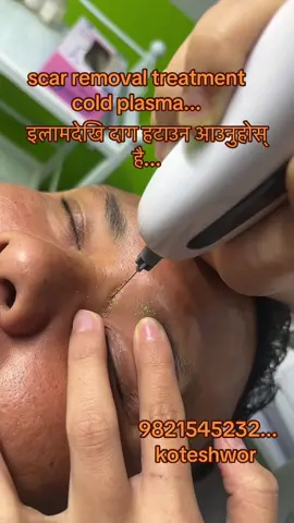 #scar #remove #pigmentation #daag #fyppppppppppppppppppppppp 