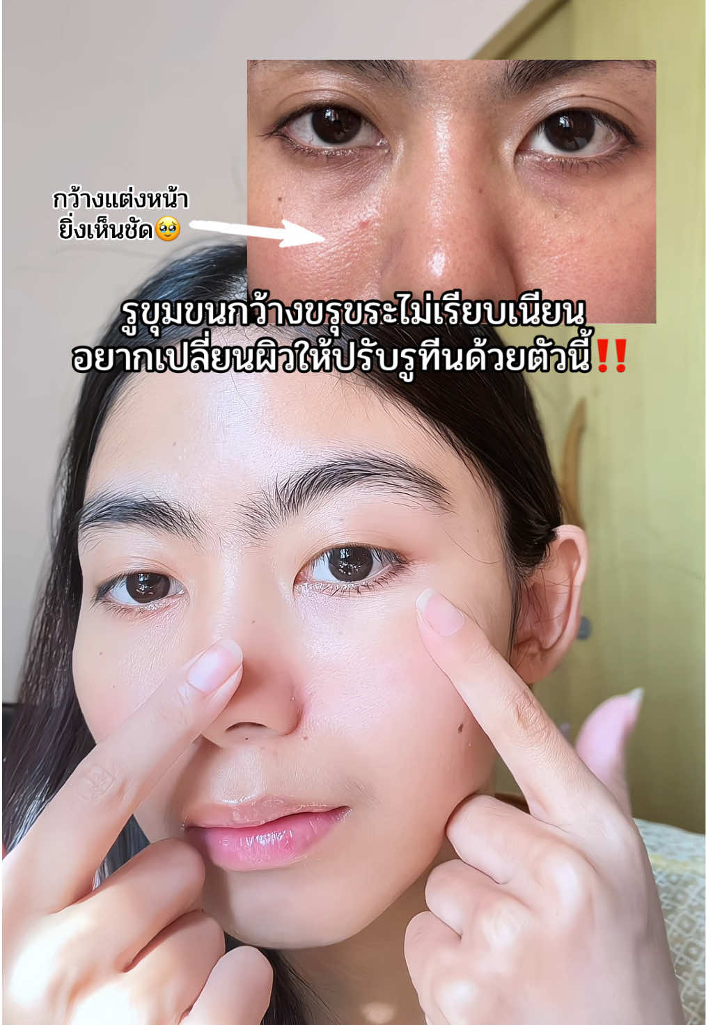 แค่ปรับเปลี่ยนรูทีนเล็กๆด้วยตัวนี้⁉️ #รูขุมขนกว้าง #รูขุมขนกระชับ #น้ำตบไมโครเอสเซนส์blahmbooh #blahmboohthailand #แก้วนักสู้คู่รีวิว 