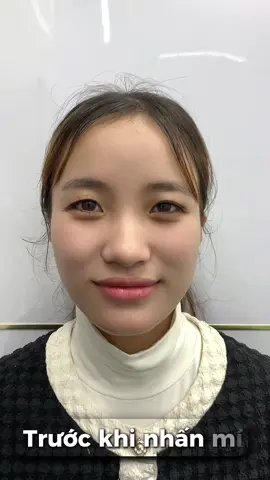 Nhấn mí vừa làm xong 