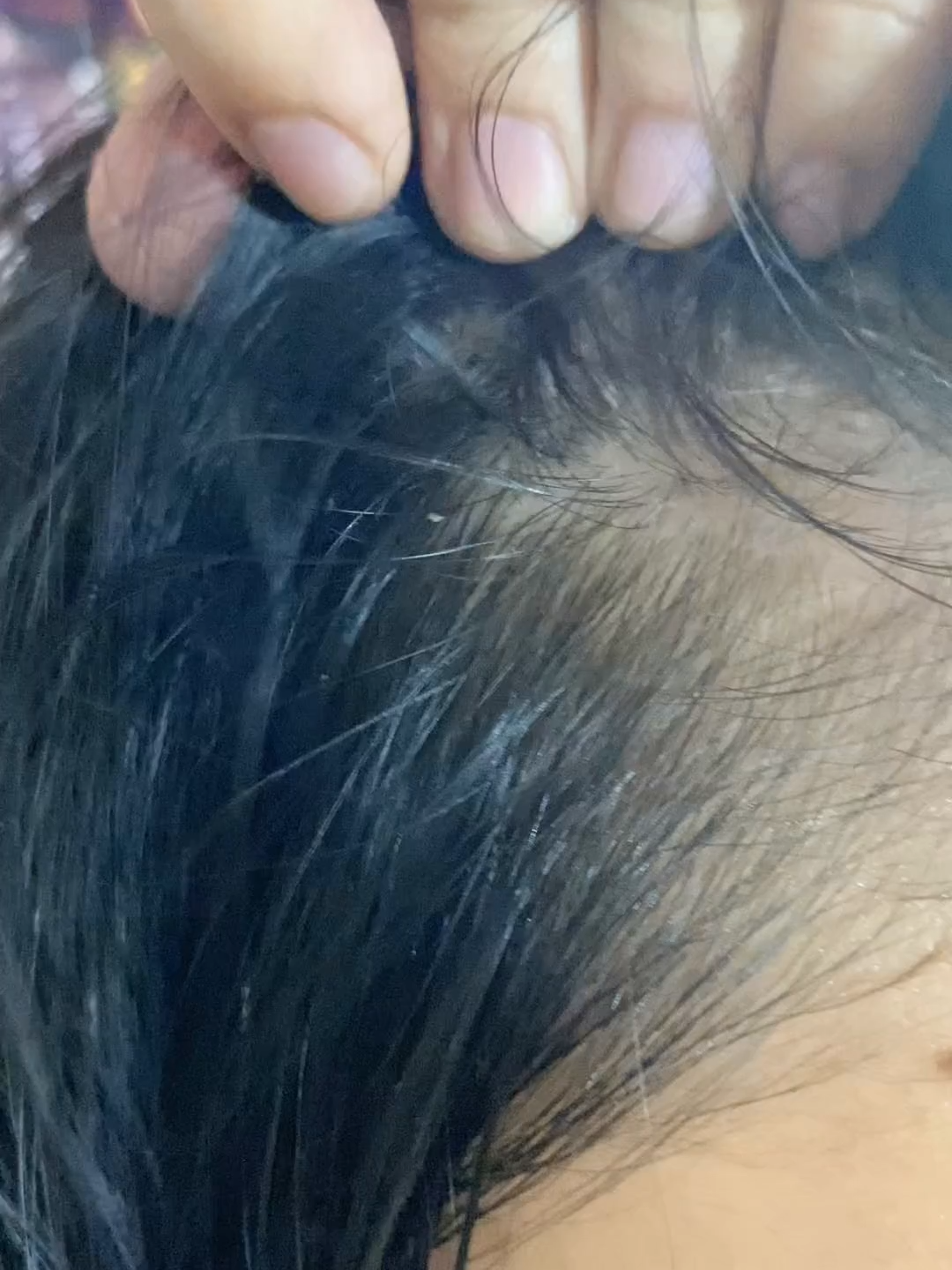 Biocarephar user experience #30 #CleanWithBio #BiocarepharPH #NoMoreDandruff #HaircarePH